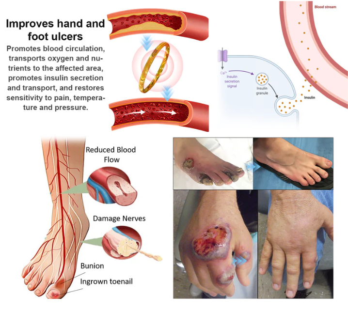 Lymphatic Magnetic Therapy Cat’s Eye Ring