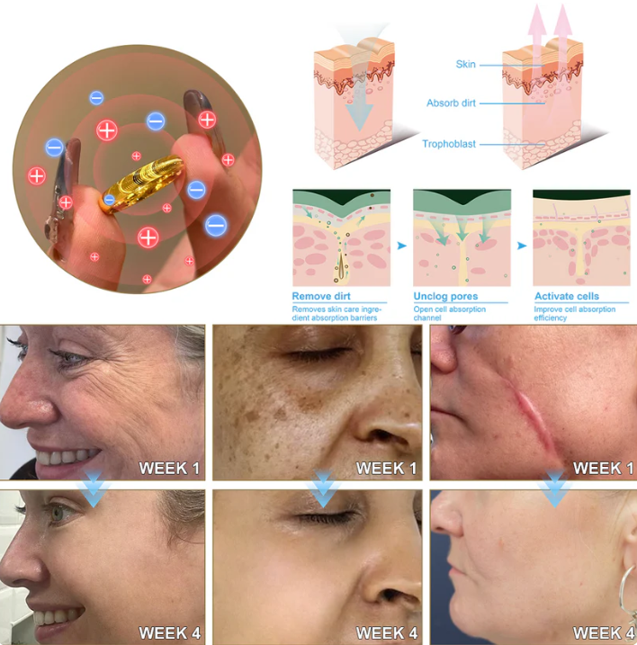 Lymphatic Magnetic Therapy Cat’s Eye Ring