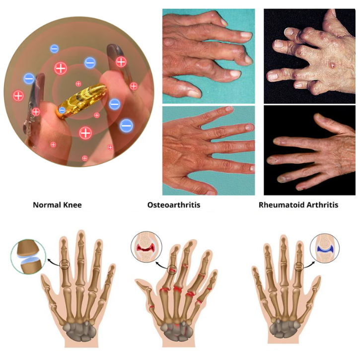 Lymphatic Magnetic Therapy Cat’s Eye Ring