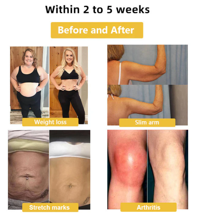 Lymphatic Magnetic Therapy Cat’s Eye Ring