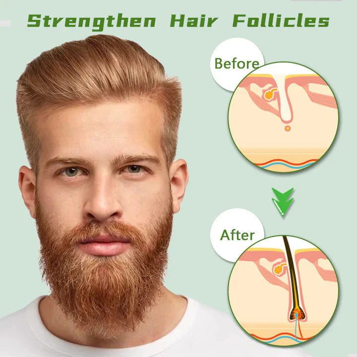 Fivfivgo™ Roter Ginseng Haarwachstumsspray