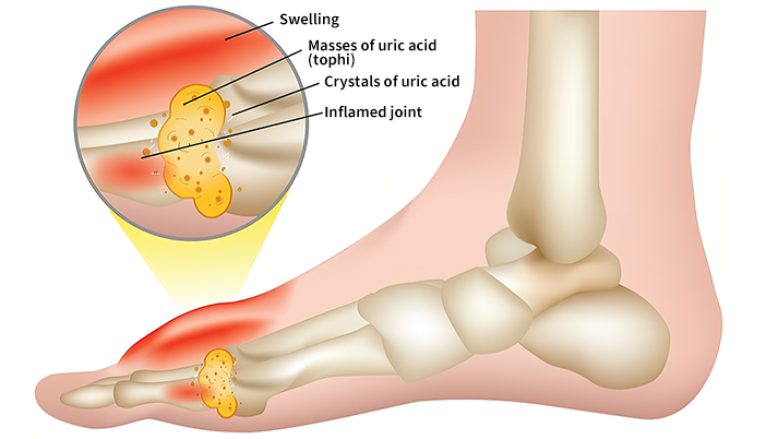 Fivfivgo™ Bee Venom Advanced Joint and Bone Therapy Cream (New Zealand Bee Extract - Specializes in Orthopedic Diseases and Arthritis Pain)