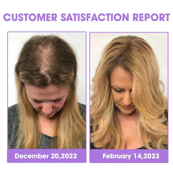 Fivfivgo™ Réparation du follicule pileux Gouttes pour la croissance des cheveux - Atteindre des cheveux plus épais rapidement