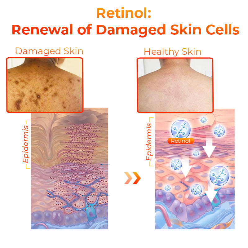 Fivfivgo™ Kojic Acid Dark Spot Corrector Soap