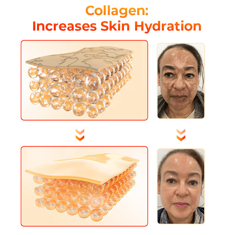 Fivfivgo™ Kojic Acid Dark Spot Corrector Soap