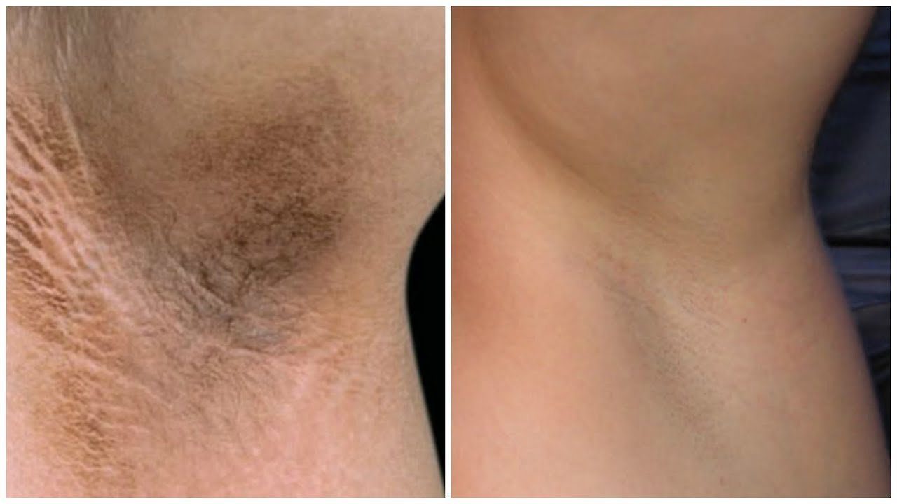 Multi-purpose Pinkish Cream