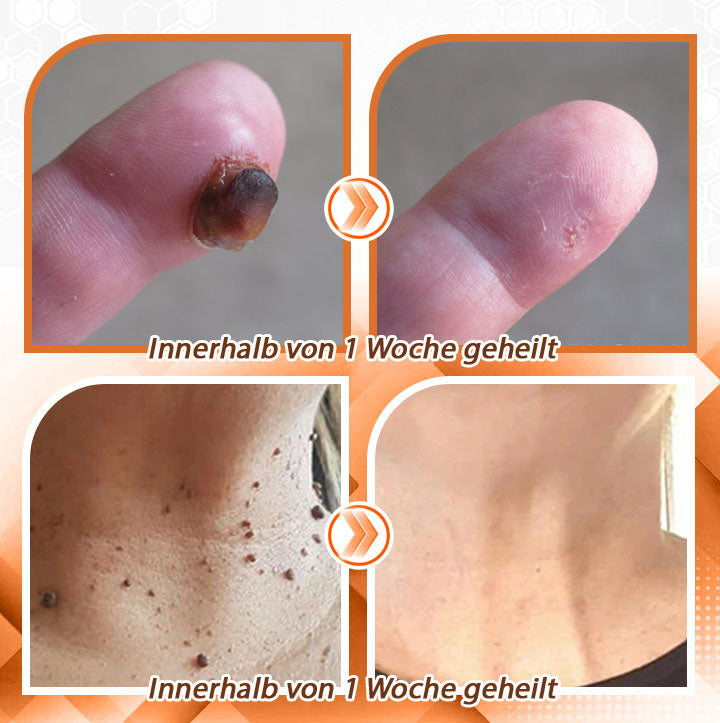 Fivfivgo™ Bienengift Schnelle Hilfe Vielseitiges Hautspray🇩🇪 Dermatologisch geprüft