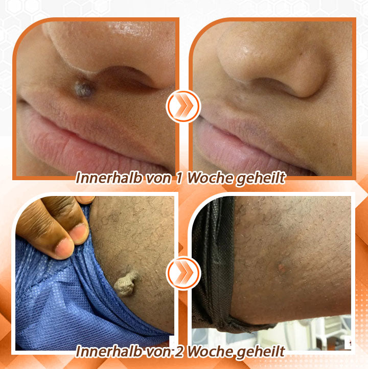 Fivfivgo™ Bienengift Schnelle Hilfe Vielseitiges Hautspray🇩🇪 Dermatologisch geprüft