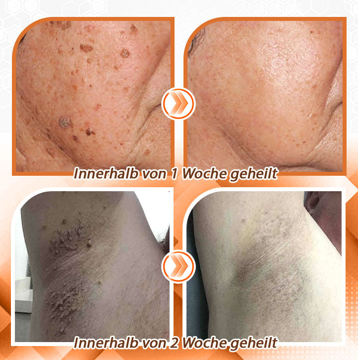 Fivfivgo™ Bienengift Schnelle Hilfe Vielseitiges Hautspray🇩🇪 Dermatologisch geprüft