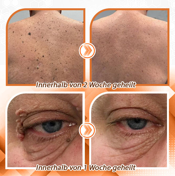 Fivfivgo™ Bienengift Schnelle Hilfe Vielseitiges Hautspray🇩🇪 Dermatologisch geprüft