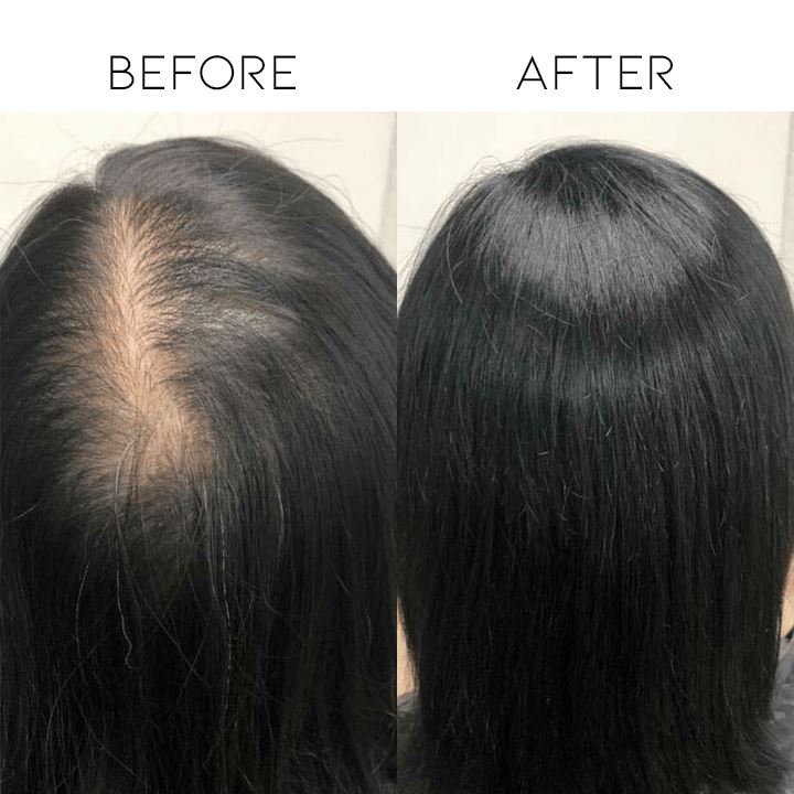 Natural Clip-In Hair Topper Morning Shades 