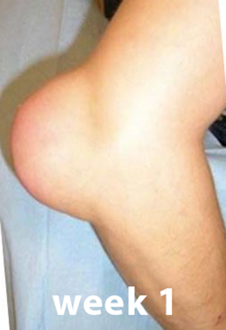 Fivfivgo™ Bee Venom Advanced Joint and Bone Therapy Cream (New Zealand Bee Extract - Specializes in Orthopedic Diseases and Arthritis Pain)