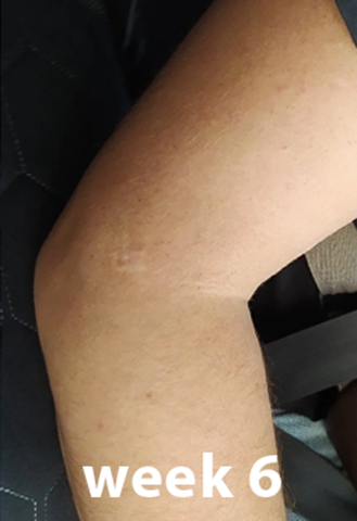 Fivfivgo™ Bee Venom Advanced Joint and Bone Therapy Cream (New Zealand Bee Extract - Specializes in Orthopedic Diseases and Arthritis Pain)