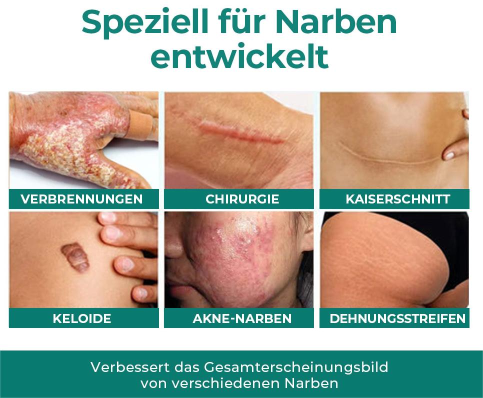 Fivfivgo™ Fortschrittliches Medizinisches Stammzellen-Narbengel