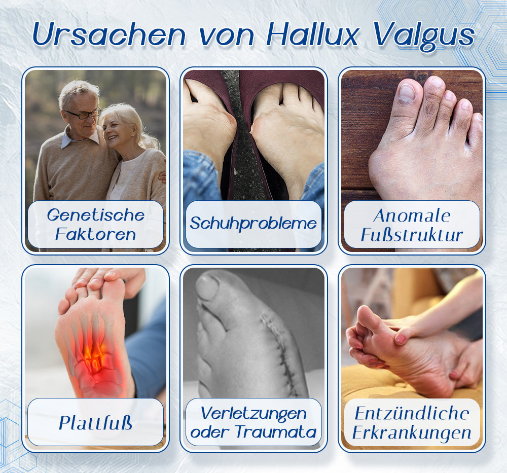 Fivfivgo™ Hallux-Valgus-Korrekturhilfe