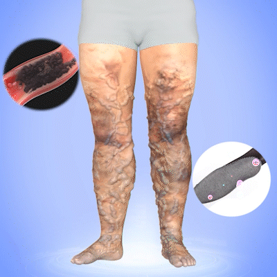 Fivfivgo™ Tourmaline Ions Magnetic Fiber Ice Silk Socks
