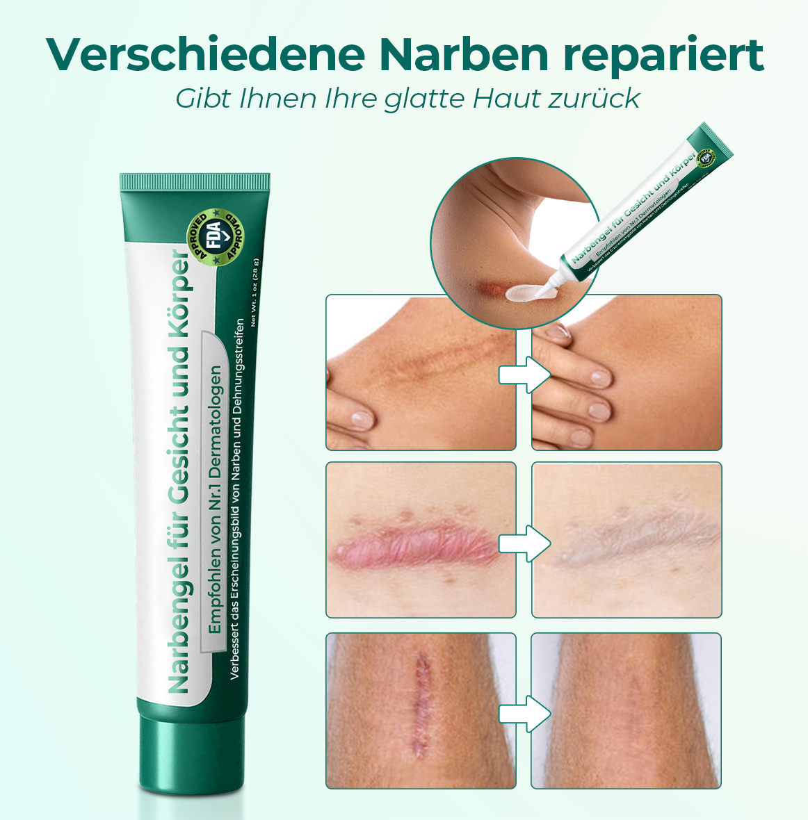 Fivfivgo™ Fortschrittliches Medizinisches Stammzellen-Narbengel