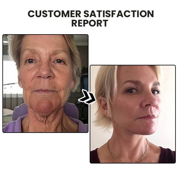 Fivfivgo™ Organics Retinol Cream