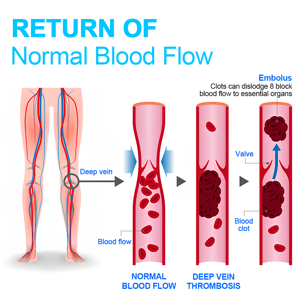 Fivfivgo™ Ionic Correction Lymphatic Detoxification Long Tube Silk Stockings