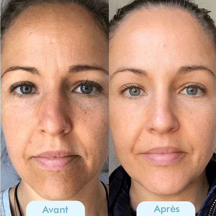 Oveallgo™ Masque Coréen Bio-Collagène Profond Réel