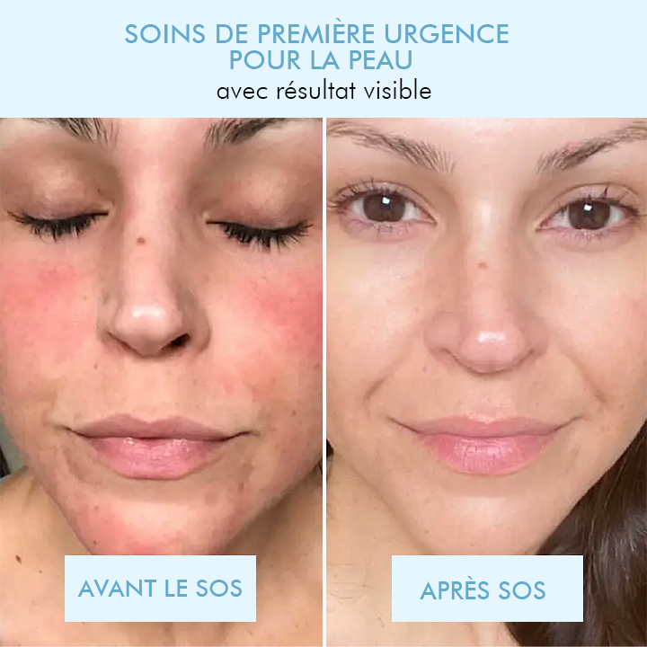 Oveallgo™ Masque Coréen Bio-Collagène Profond Réel