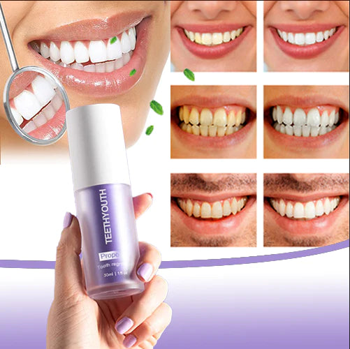 Teethyouth Tooth Whitening Gel