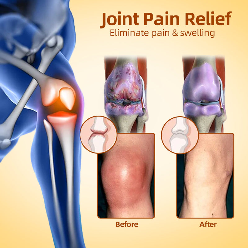 Fivfivgo™ Canadian Bee Venom Alleviating Bone Pain and Repairing Bone Injuries Gel