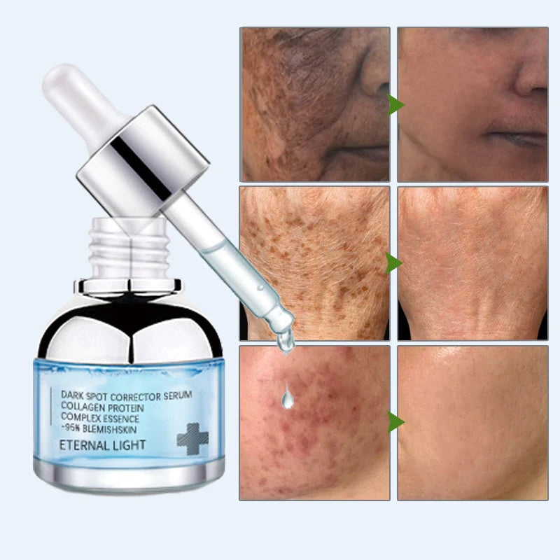 Dark Spot Corrector & Anti-Aging Collagen Serum