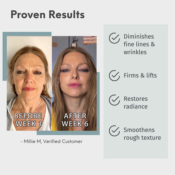 Fivfivgo™ Luxus-Hyaluronsäure-Anti-Aging-Serum