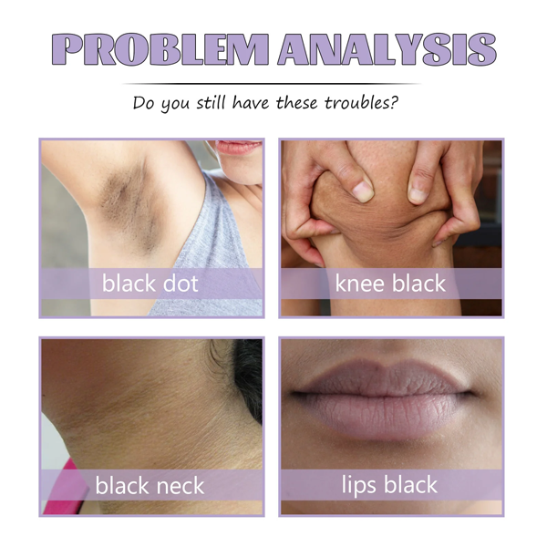 Fivfivgo™ Collagen Acanthosis Nigricans Therapy Cream