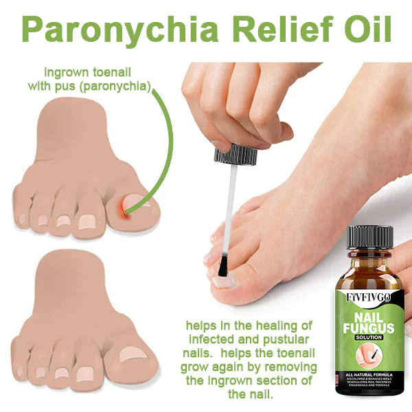 Fivfivgo™ FootCure Removal Paronychia Gel