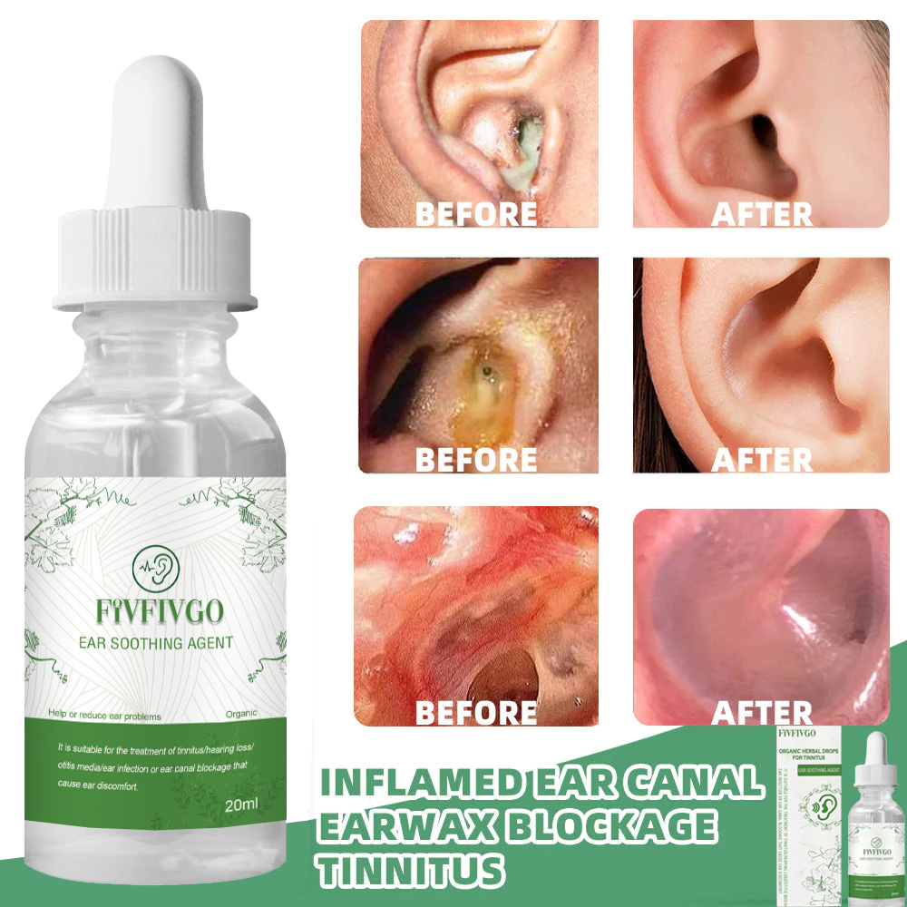 Fivfivgo™ Bio-Kräutertropfen gegen Tinnitus