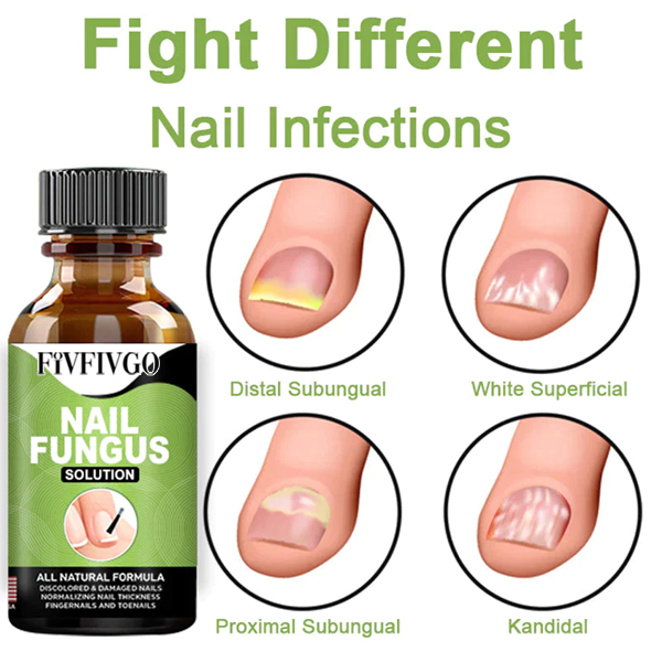 Fivfivgo™ FootCure Removal Paronychia Gel