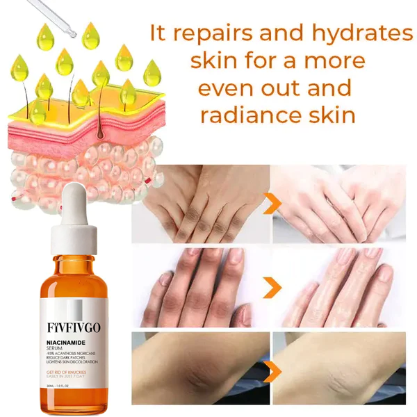 Fivfivgo™ Advanced Skin Brightening Serum for Melanosis and Dark Spot Removal