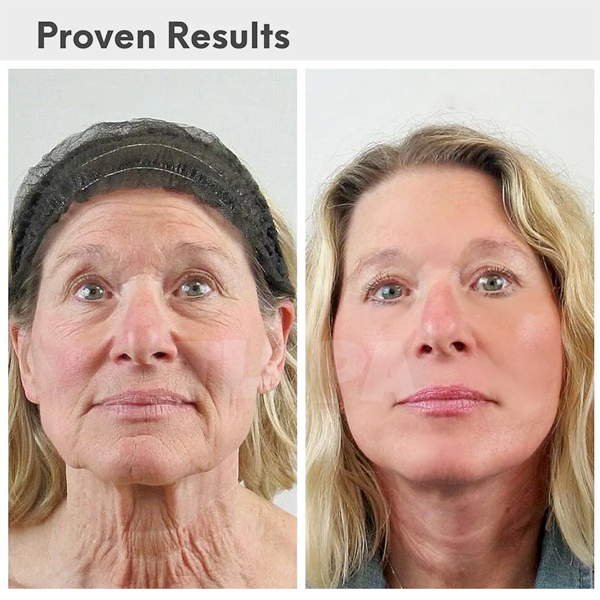 Fivfivgo™ Luxury Hyaluronic Acid Anti-Aging Serum