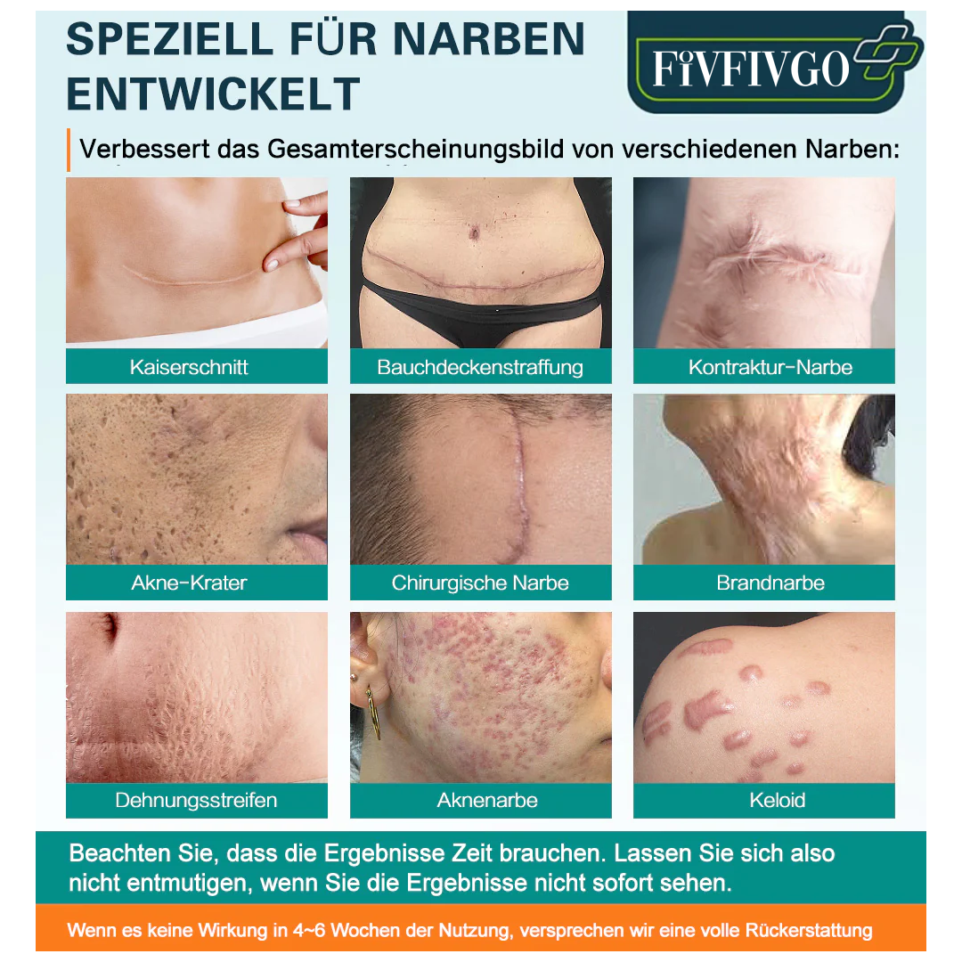 Fivfivgo™ Advanced Narbenentfernungsspray