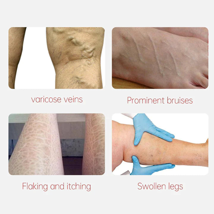 Fivfivgo™ Varicose Veins Relief Cream