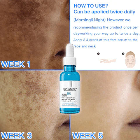 ReYouthBio™ Anti-acne Spot Corrector Serum