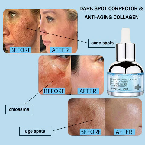 Dark Spot Corrector & Anti-Aging Collagen Serum