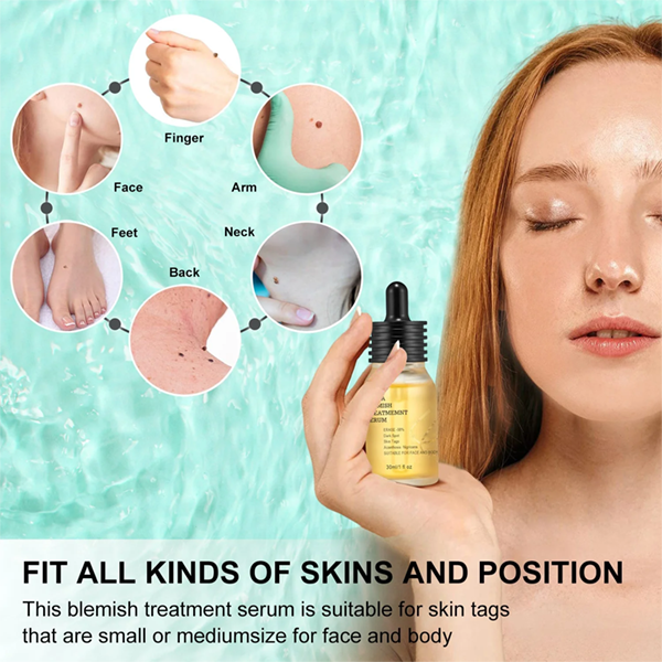 Fivfivgo™ Blemish Treatment Serum für dunkle Flecken & Acanthosis Nigricans & Skin Tag