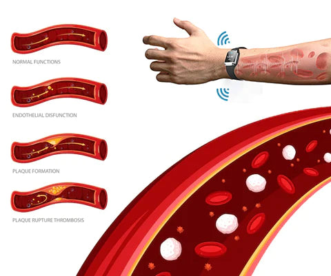 Slimani Ultrasonic Body Shape Wristband