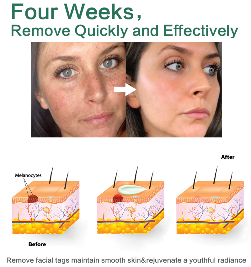 Fivfivgo™ Herbal Natural Spot & Mole Cream