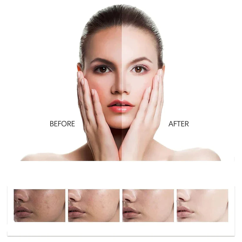 Fivfivgo™ Depigmenting and Toxin-removing Body Soap