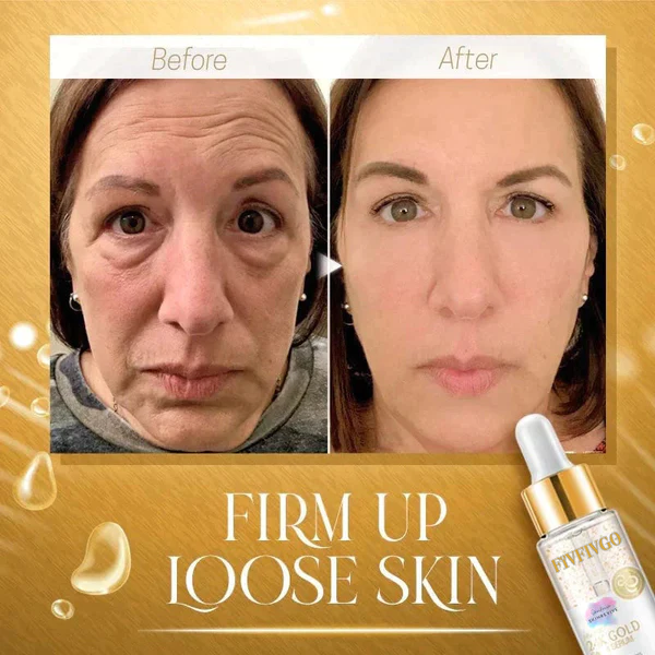 Fivfivgo™ SkinRevive Collagen Booster Serum