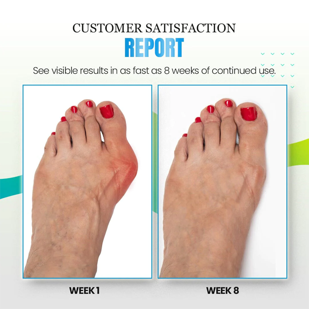 Fivfivgo™ Anti-Bunions & Varicose Veins Health Sock