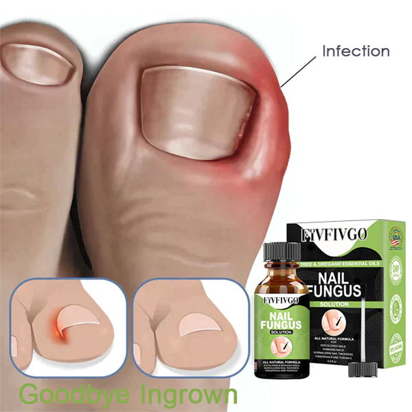 Fivfivgo™ FootCure Removal Paronychia Gel