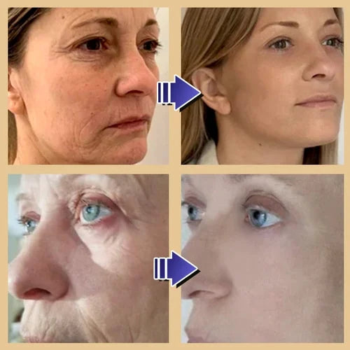 YoungerMi Seaweed Collagen Tightening Eye Mask Patch