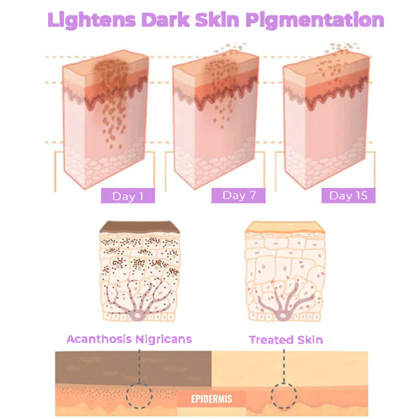 Fivfivgo™ Collagen Acanthosis Nigricans Therapy Cream