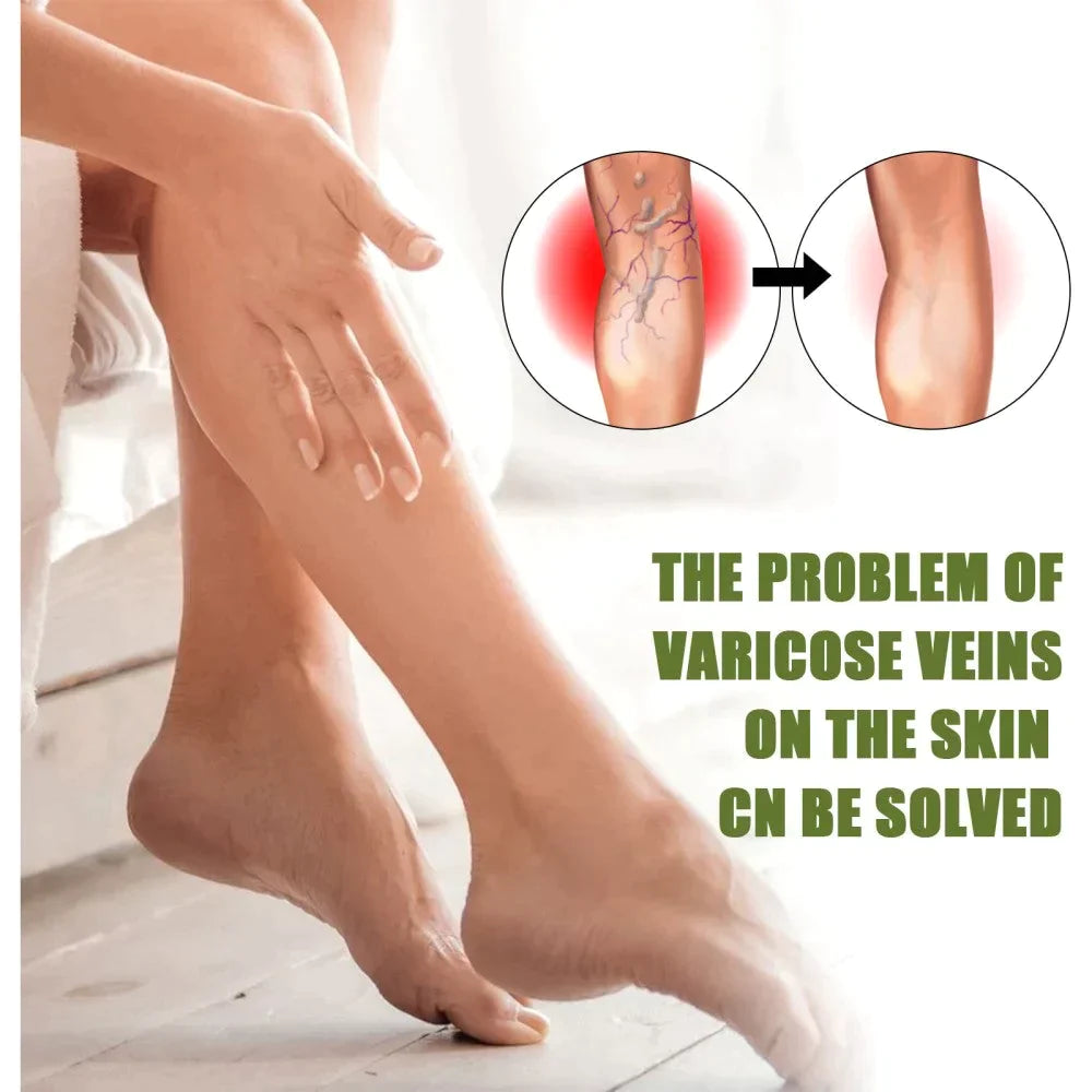 Fivfivgo™ Varicose Veins Spray
