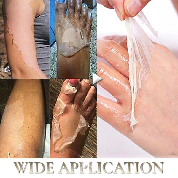 Fivfivgo® Natural Spots Whitening Yellow Peeling Oil